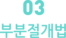 부분절개법