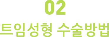 트임성형 수술방법